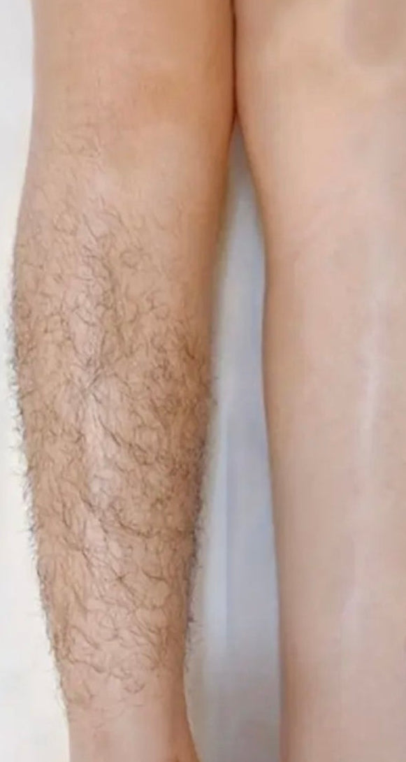 Mini epilator